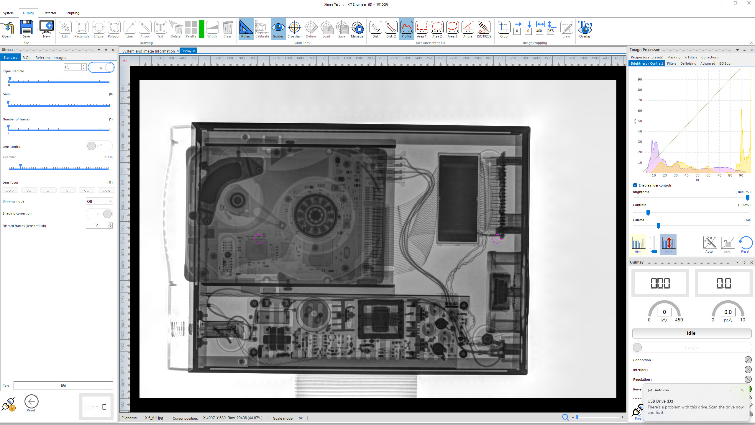 X Ray Computer Software Xi-DIS X-ray Digital Imaging System - X-Innovations Technologies Ltd X ...